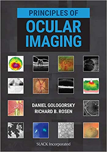 Gologorsky D, Rosen RB. Principles of Ocular Imaging